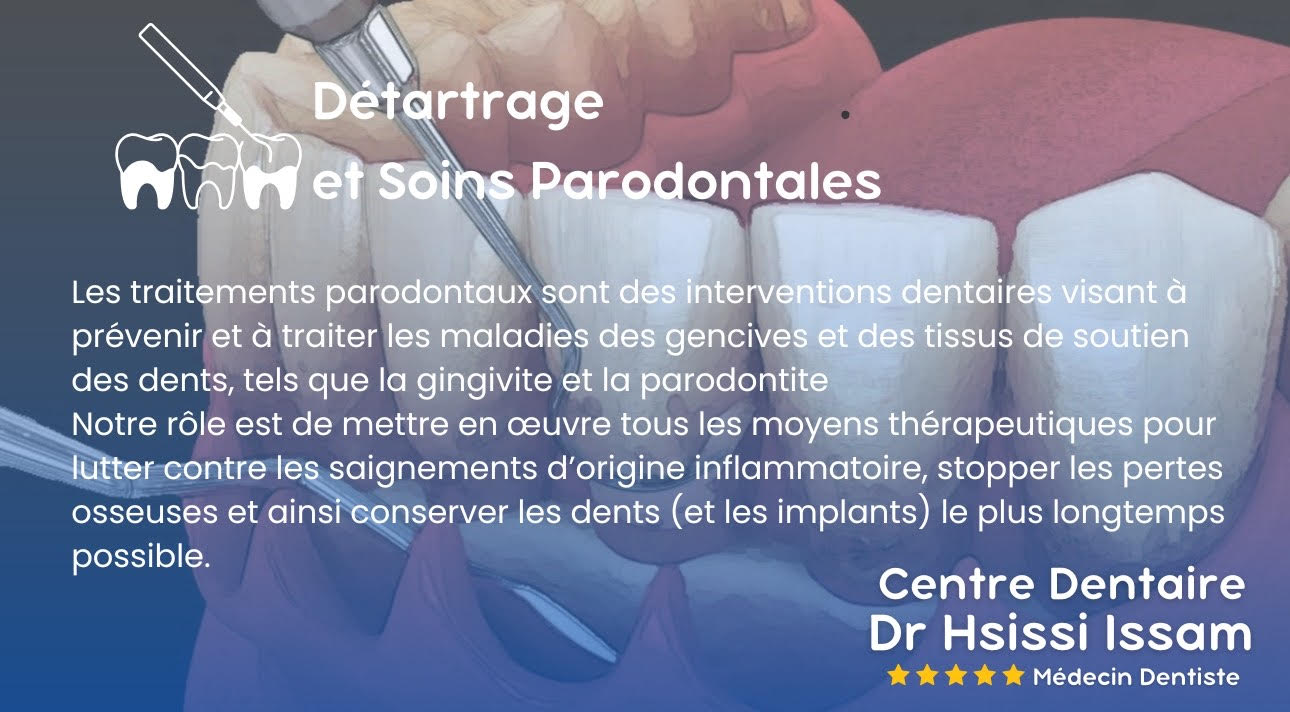 Centre Dentaire Dr Hsissi Issam - sidi El Bernoussi Casablanca - Esthétique de sourire -Soins Dentaires -Chirurgie - Couronnes et prothèse - atteintes de la gencive et du parodonte -Orthodontie - Pédodontie 