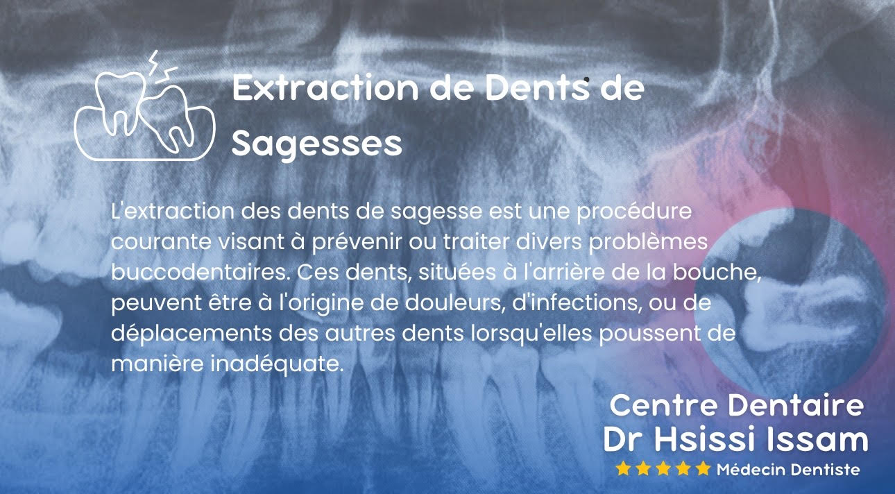 Centre Dentaire Dr Hsissi Issam - sidi El Bernoussi Casablanca - Esthétique de sourire -Soins Dentaires -Chirurgie - Couronnes et prothèse - atteintes de la gencive et du parodonte -Orthodontie - Pédodontie 