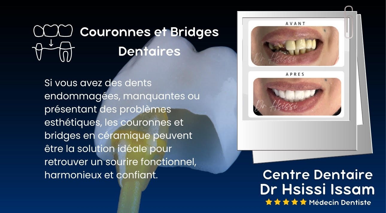 Centre Dentaire Dr Hsissi Issam - sidi El Bernoussi Casablanca - Esthétique de sourire -Soins Dentaires -Chirurgie - Couronnes et prothèse - atteintes de la gencive et du parodonte -Orthodontie - Pédodontie 