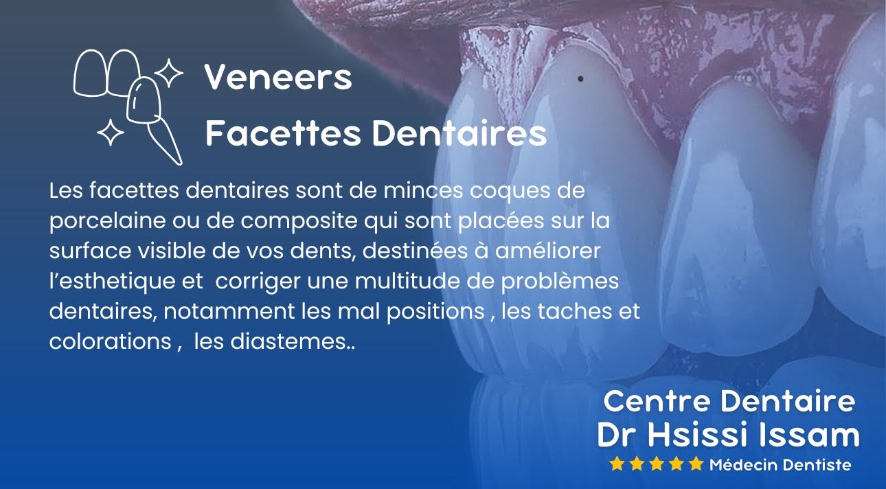 Centre Dentaire Dr Hsissi Issam - sidi El Bernoussi Casablanca - Esthétique de sourire -Soins Dentaires -Chirurgie - Couronnes et prothèse - atteintes de la gencive et du parodonte -Orthodontie - Pédodontie 