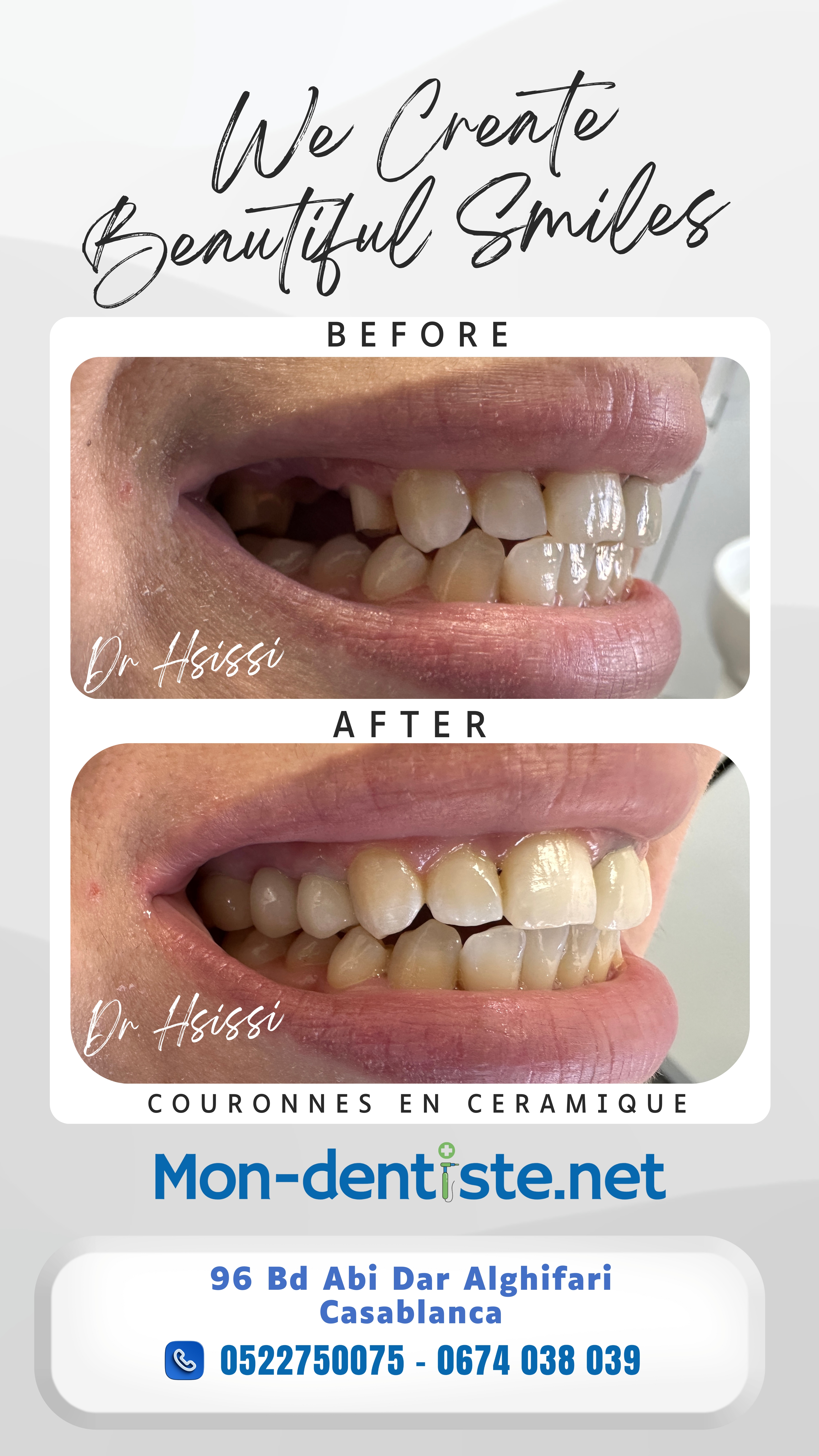 Centre Dentaire Dr Hsissi Issam - sidi El Bernoussi Casablanca - Esthétique de sourire -Soins Dentaires -Chirurgie - Couronnes et prothèse - atteintes de la gencive et du parodonte -Orthodontie - Pédodontie 