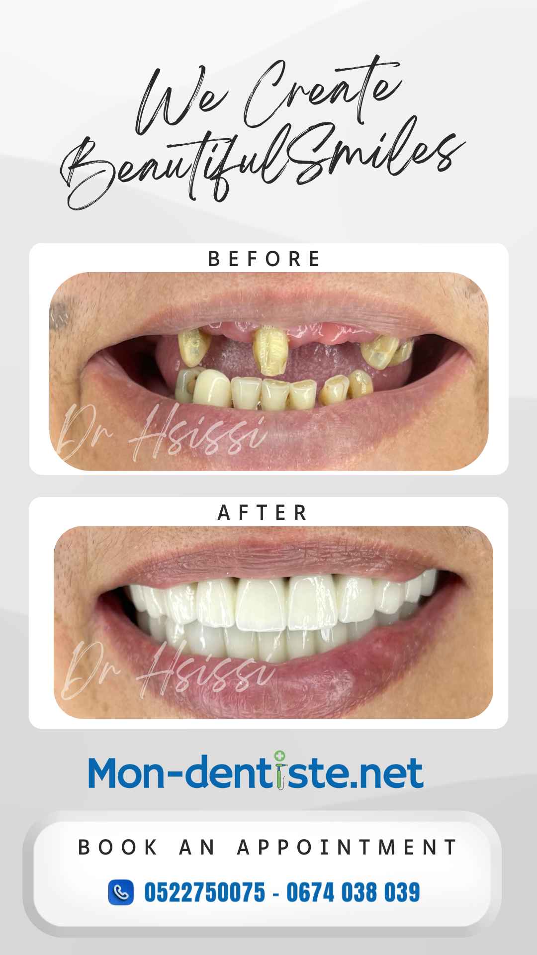 Clinique dentaire Hsissi Issam Casablanca • Orthodontiste ● Hollywood Smile ● Orthodontie ● Pédodontie